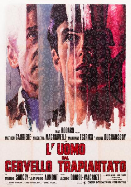 L'uomo dal cervello trapiantato