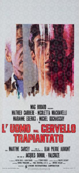 L'uomo dal cervello trapiantato